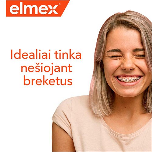 idealiai tinka nesiojant breketus