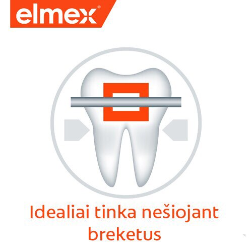 idealiai tinka nesiojant breketus